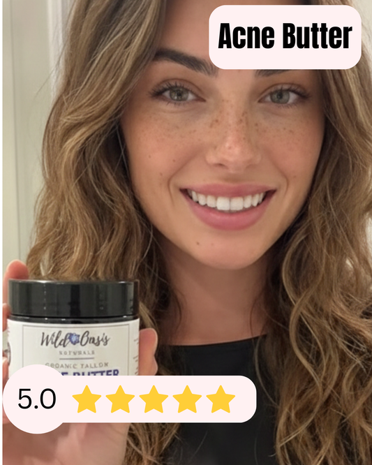Acne Butter - Organic Tallow Acne Cream